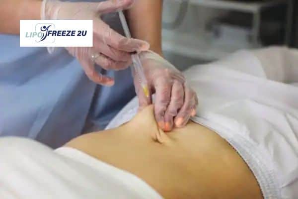 How Does Aqualyx Fat Dissolving Injection Work to Break Down Fat Dartford?