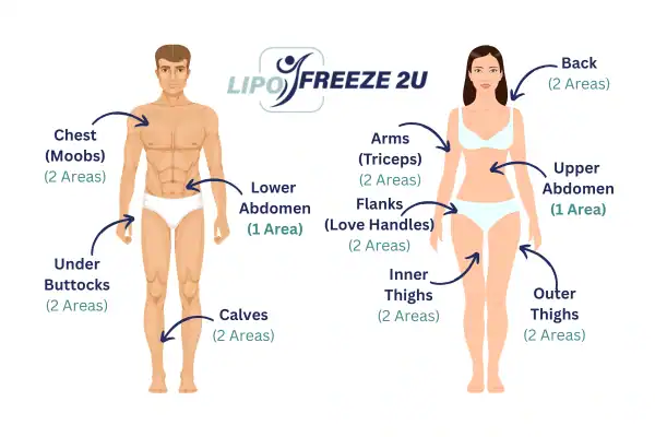 Areas you can have fat freezing treatment Dartford