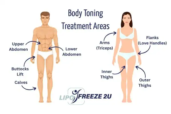 Graphic showing where you can have Body toning Treatment Dartford on your body