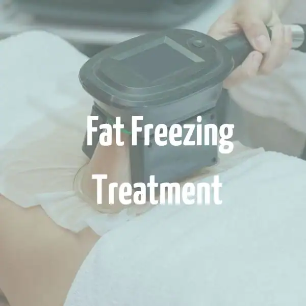 fat freezing treatment Dartford