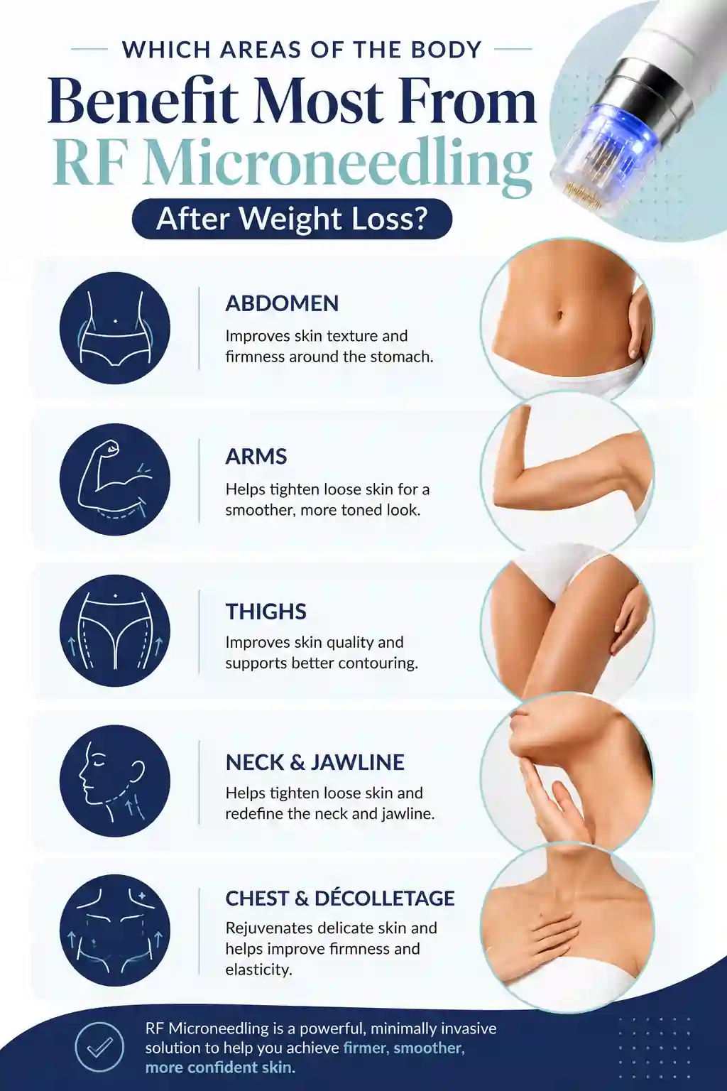 Which Areas of the Body Benefit Most From RF Microneedling After Weight Loss Dartford